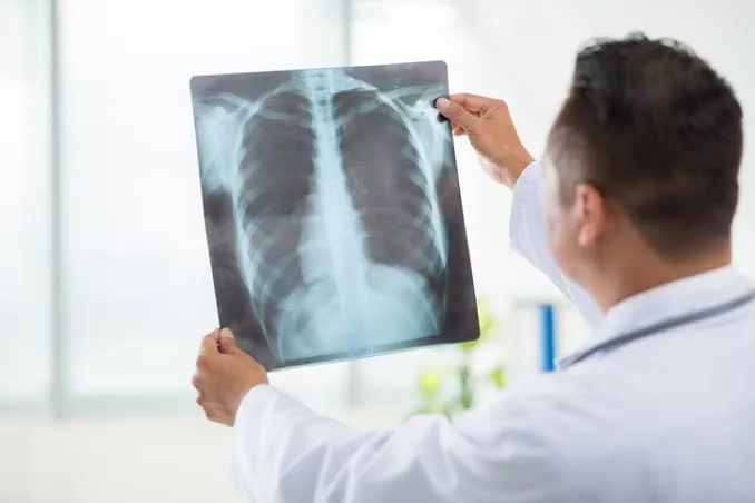 X-ray icon